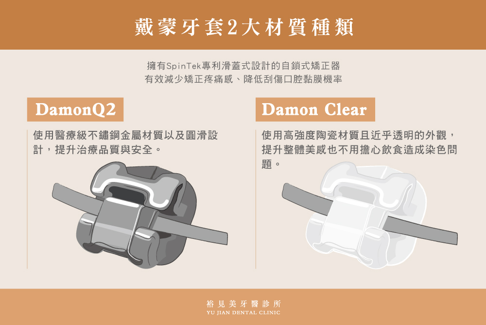 戴蒙牙套2大矯正材質：金屬DamonQ2、陶瓷Damon Clear