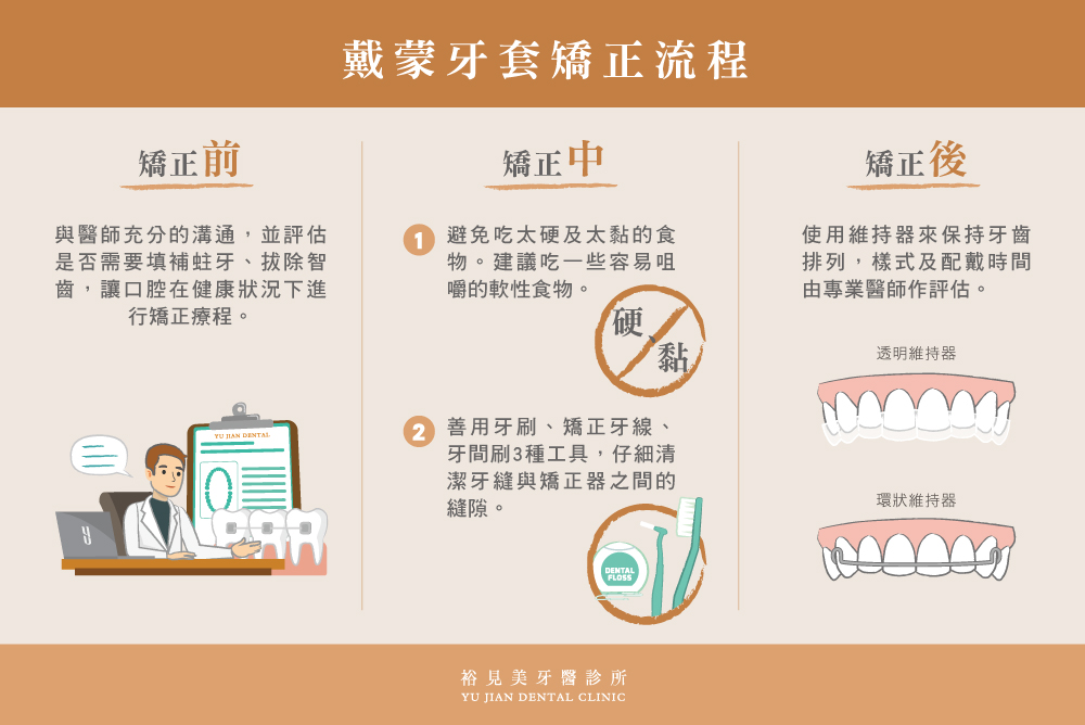 戴蒙牙套矯正前、中、後期3大流程