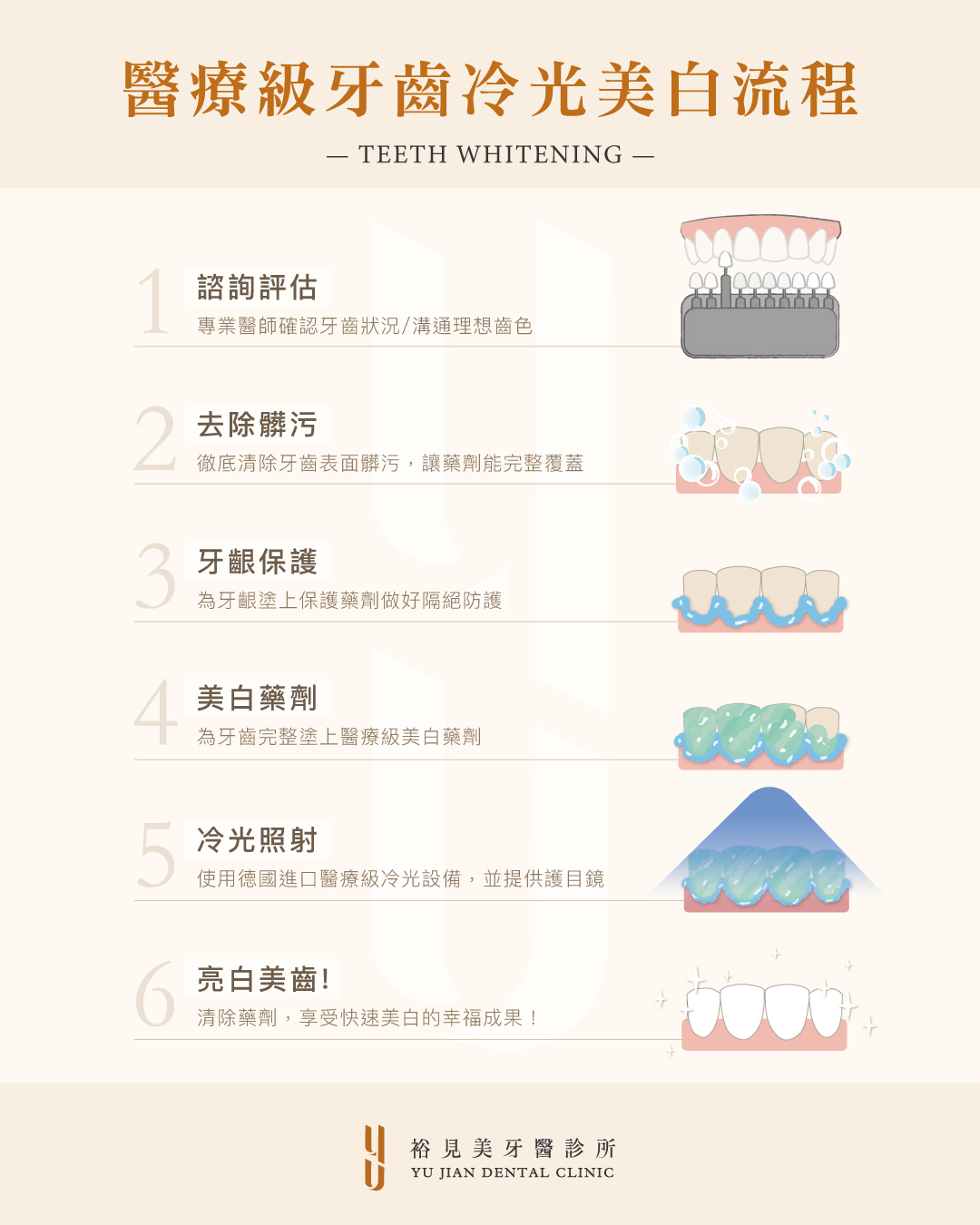 醫療級牙齒冷光美白流程